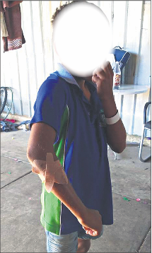 Fury over “caged boy”