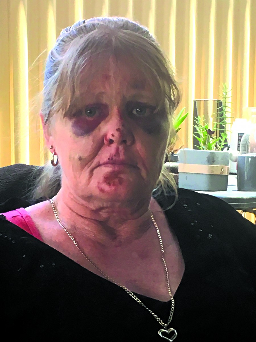 Bashing victim speaks out